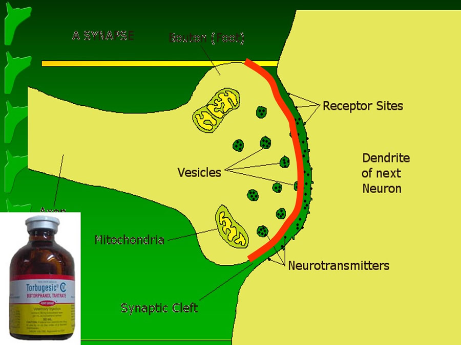 Manejo del Dolor