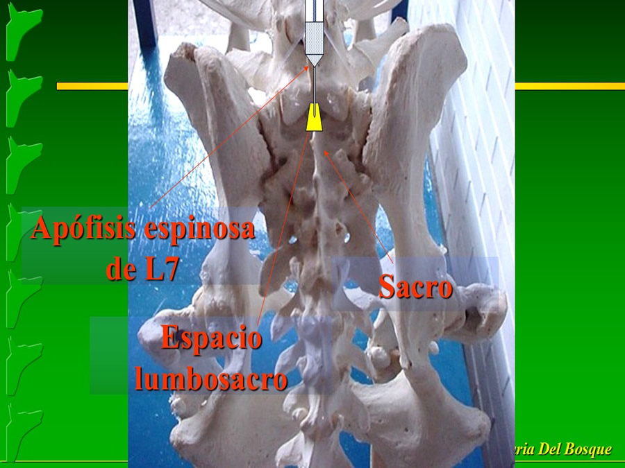 Manejo del Dolor