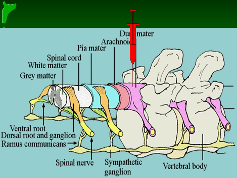 Manejo del Dolor