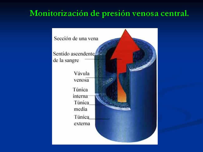 Monitorizacin del paciente en estado crtico y anestesia