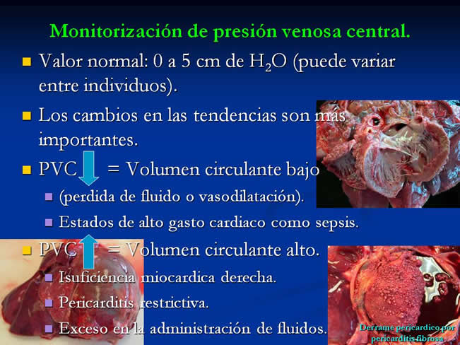 Monitorizacin del paciente en estado crtico y anestesia