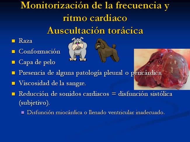 Monitorizacin del paciente en estado crtico y anestesia