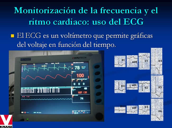 Monitorizacin del paciente en estado crtico y anestesia