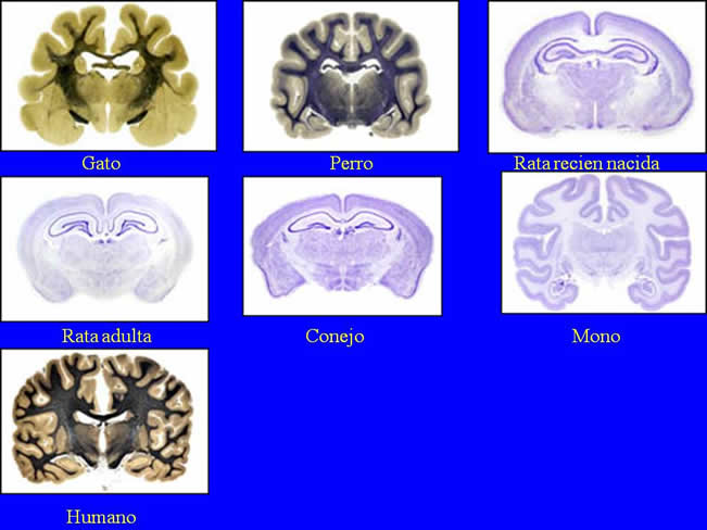 Neurologa