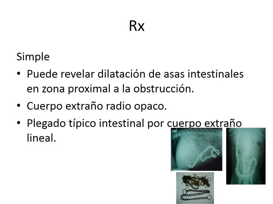 Obstruccin intestinal