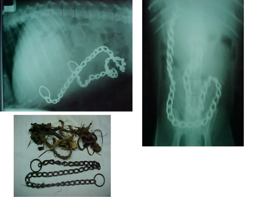 Obstruccin intestinal