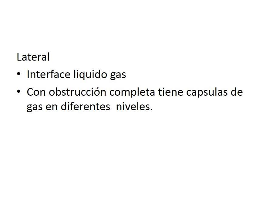 Obstruccin intestinal