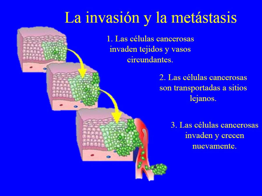 Oncologa bsica