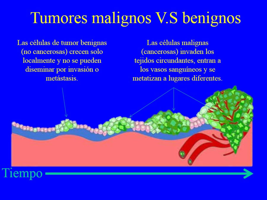 Oncologa bsica