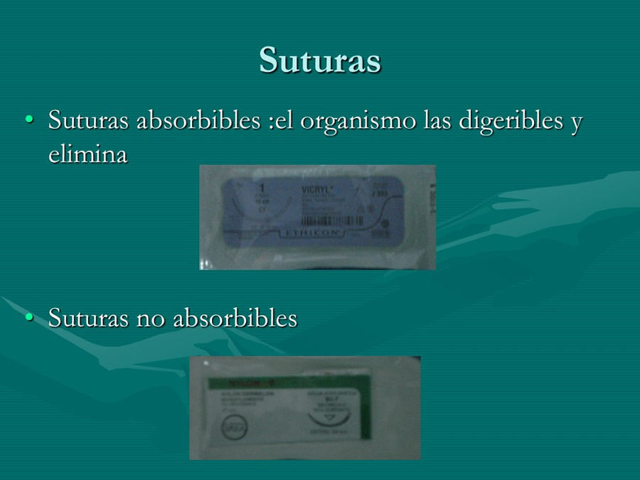 Principios de ciruga