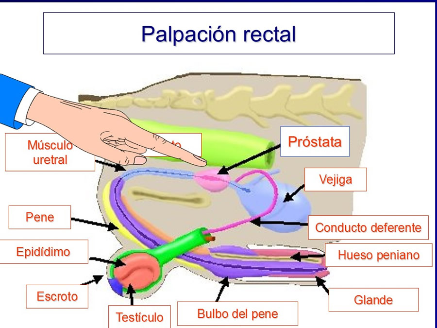 Prstata