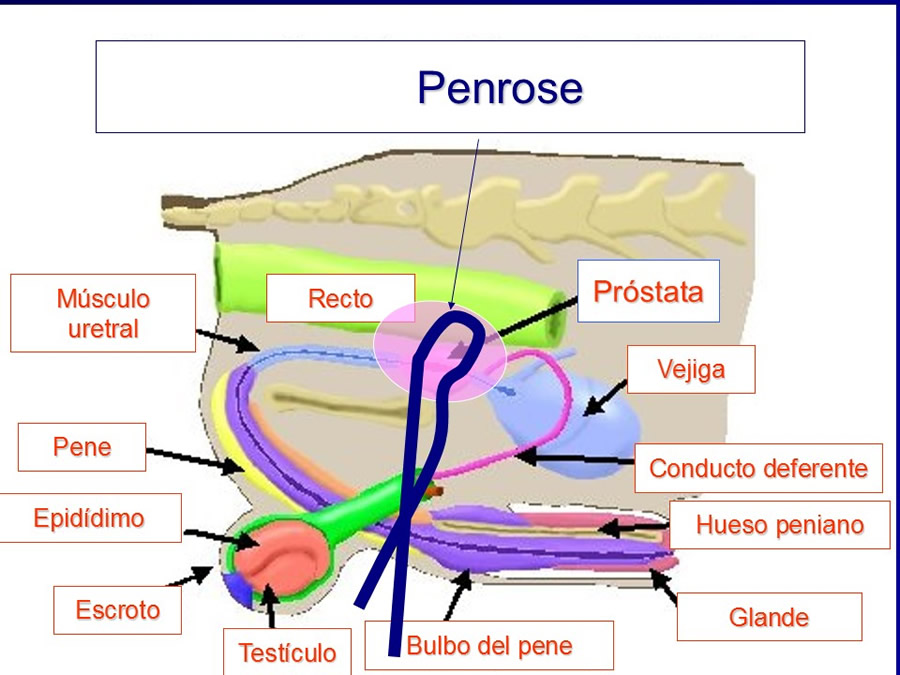 Prstata