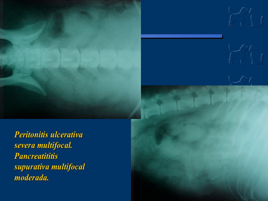 Algunos casos de trastornos gastroentericos