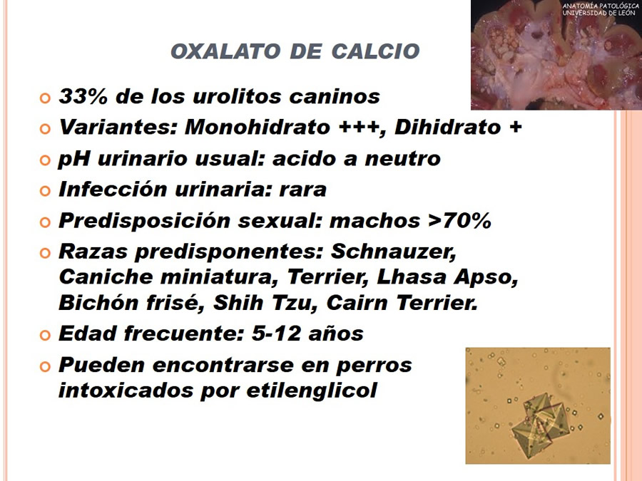 Caso Clnico, Urolitiasis