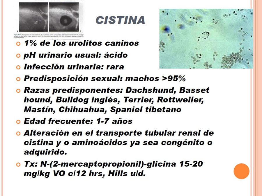 Caso Clnico, Urolitiasis