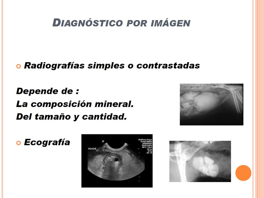 Caso Clnico, Urolitiasis