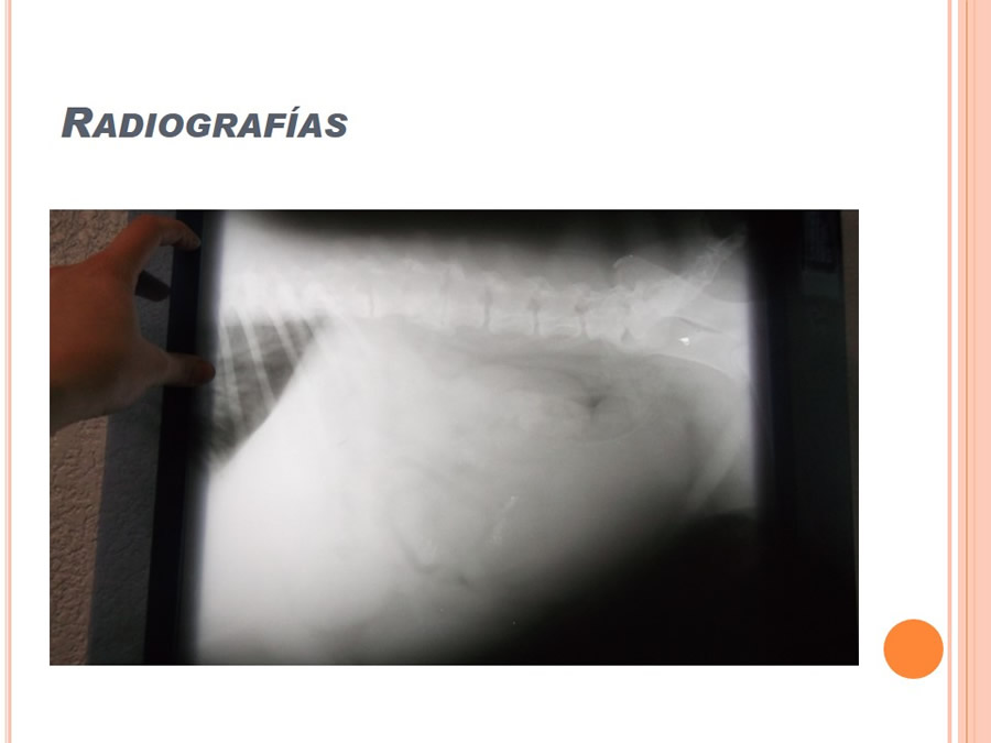 Caso Clnico, Urolitiasis