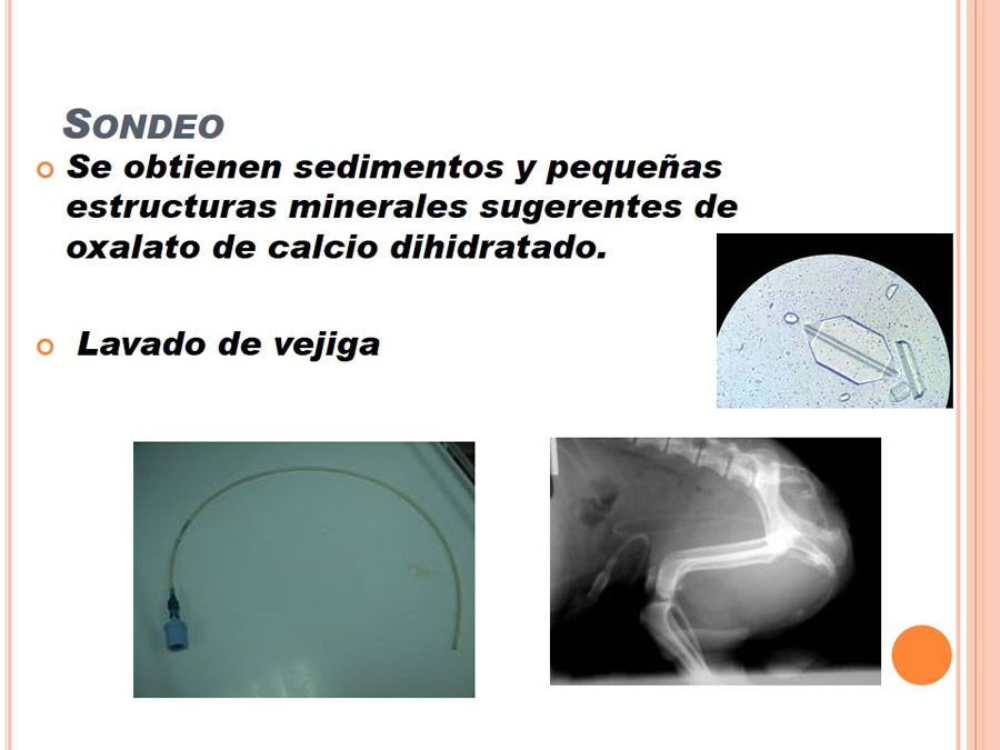 Caso Clnico, Urolitiasis