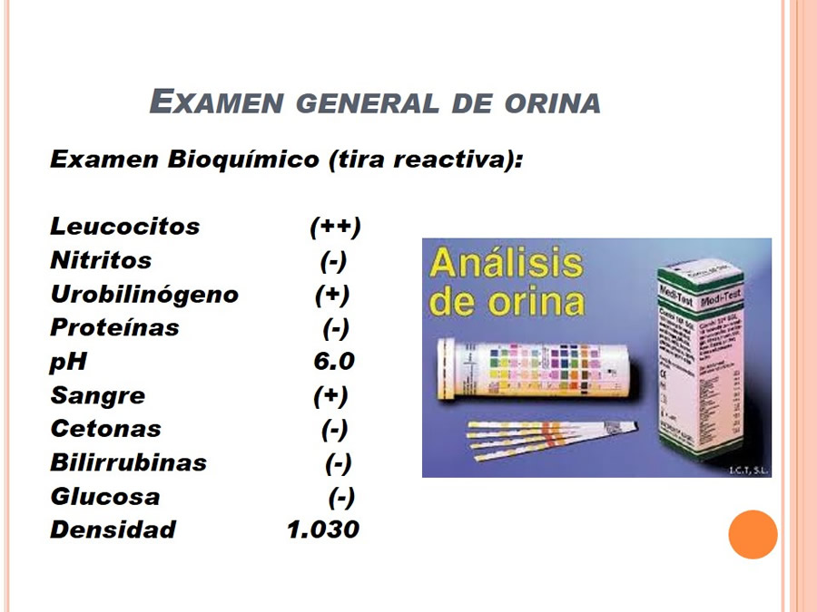 Caso Clnico, Urolitiasis