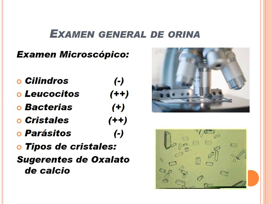 Caso Clnico, Urolitiasis