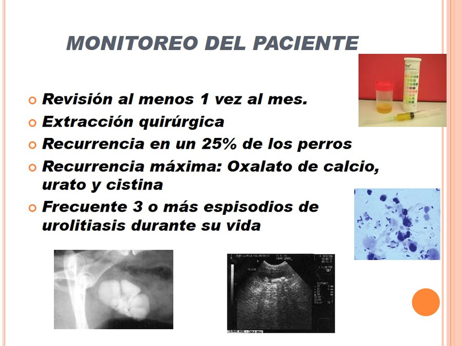 Caso Clnico, Urolitiasis