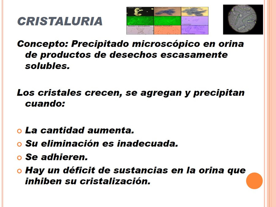 Caso Clnico, Urolitiasis