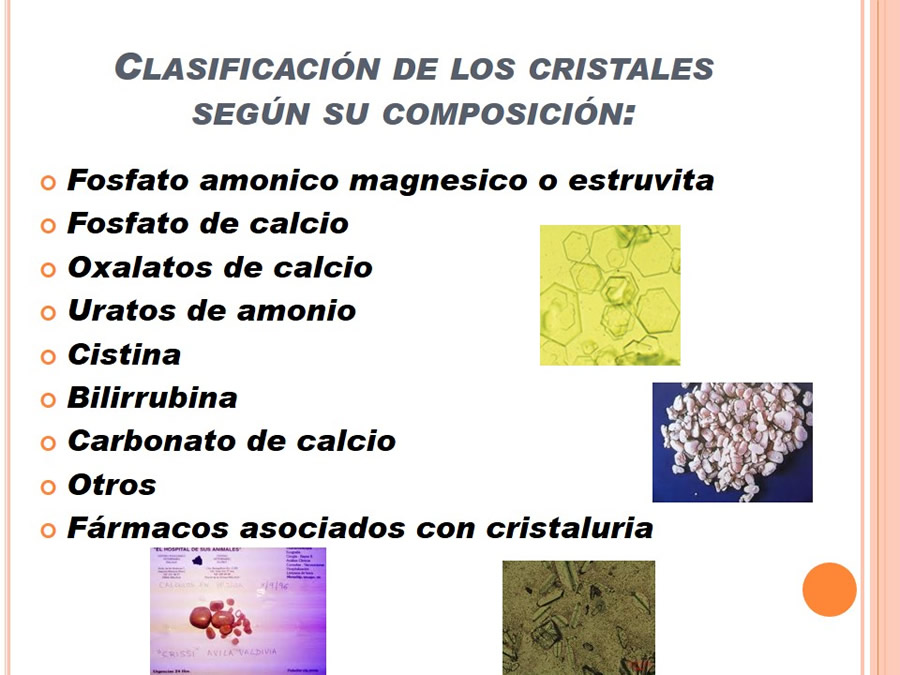 Caso Clnico, Urolitiasis