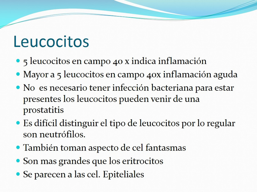 Urolitiasis