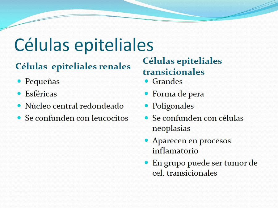 Urolitiasis