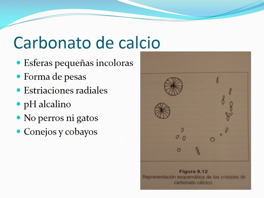 Urolitiasis