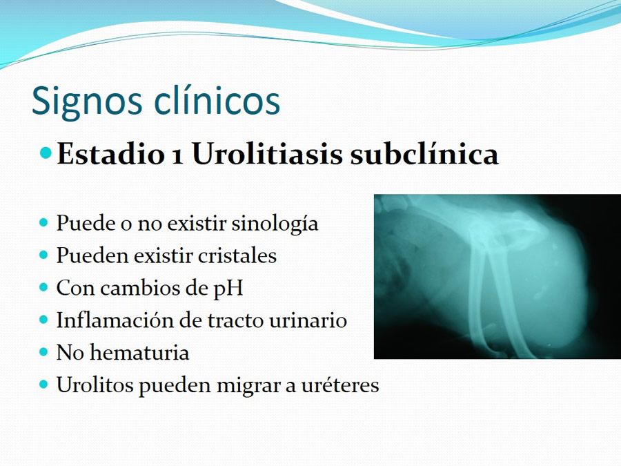 Urolitiasis