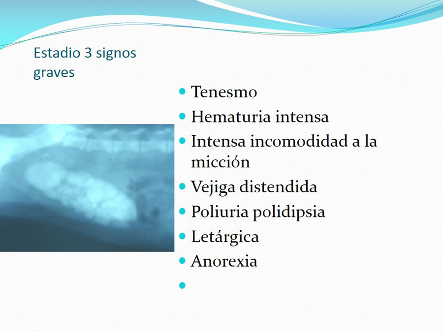 Urolitiasis