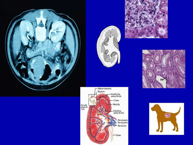 Nutricin en la enfermedad renal