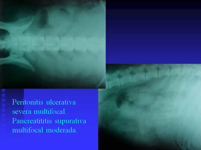 Nutricin Paraenteral Total