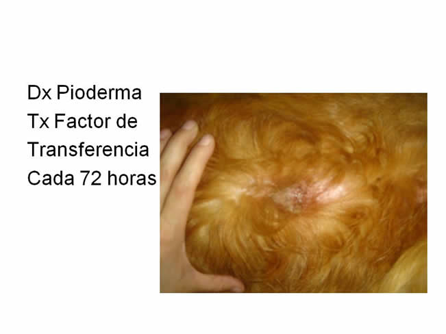 Factor de Transferencia Dermatologa