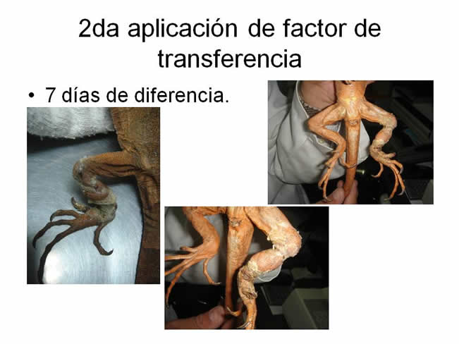 Factor de Transferencia Dermatologa