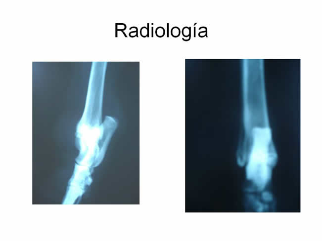 Factor de Transferencia Dermatologa