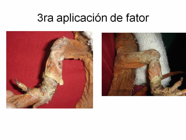 Factor de Transferencia Dermatologa