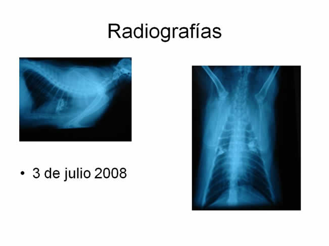 Factor de Transferencia Casos Clnicos (completos)