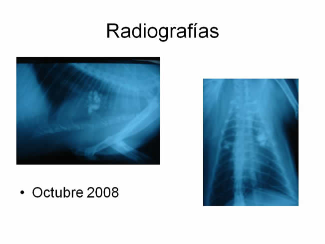 Factor de Transferencia Casos Clnicos (completos)