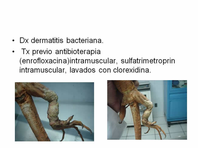 Factor de Transferencia Casos Clnicos (completos)