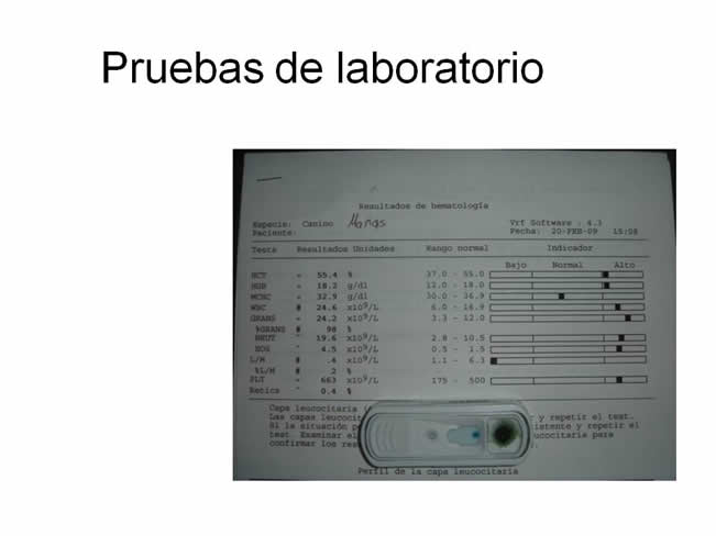 Factor de Transferencia Casos Clnicos (completos)