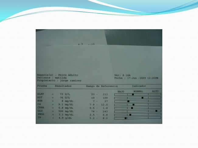 Hipoglucemia