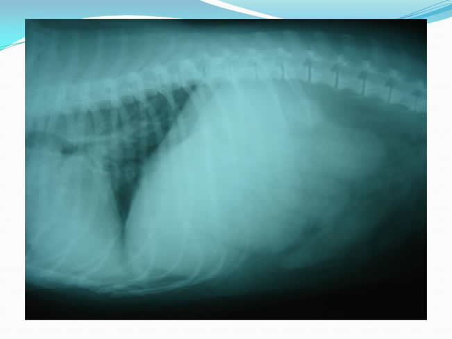 Hipoglucemia