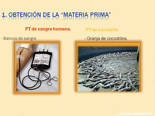 Qu es el factor de Transferencia?