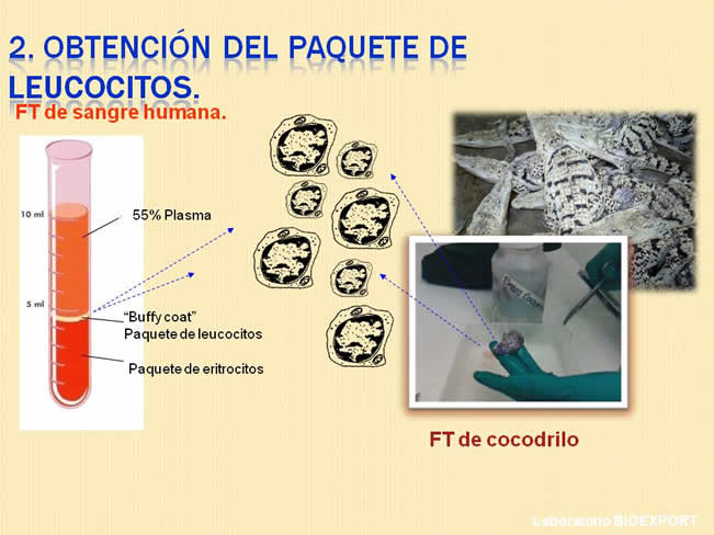 Qu es el factor de Transferencia?