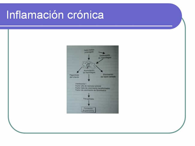 Sistema inmune