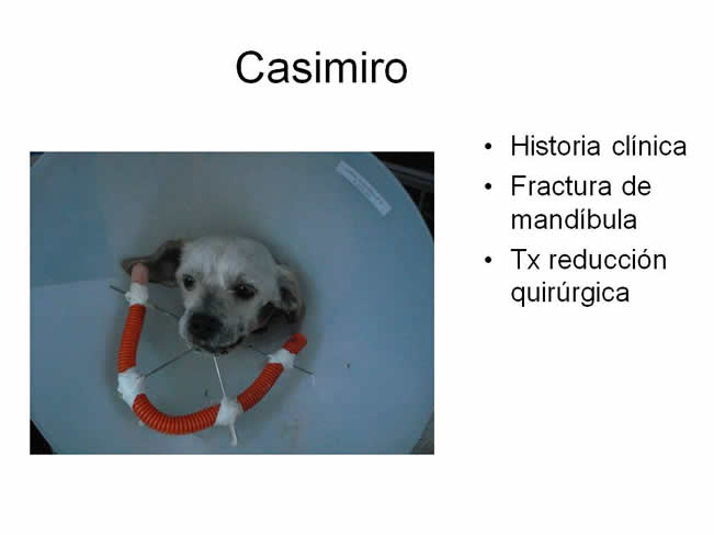 Factor de Transferencia Varios 