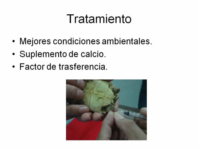 Factor de Transferencia Varios 