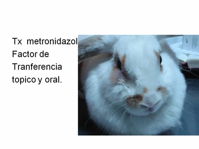 Factor de Transferencia Varios 